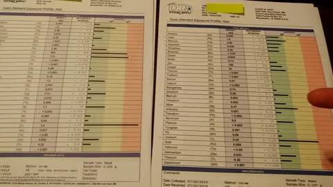 Toxicity testing: Before and After detox results with Glutathione (Doctors Data tests)