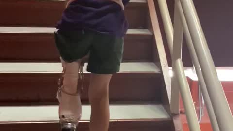 This girl is unstoppable! First full flight of stairs for this new amputee!