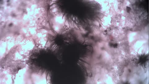 Teslaphoresis of Graphenated Hydrogel with Antennae Surrounded by Microfilarae Parasites