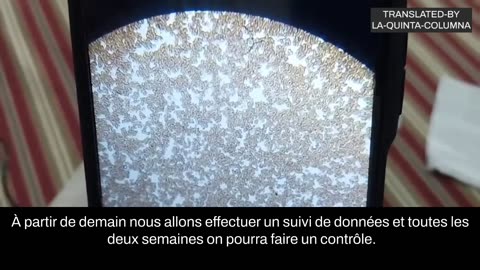 Analyse microscopique d'une goutte de sang d'une personne "vaccinée" avec Sinopharm