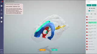 Canine brain ventricles - 3D Veterinary Anatomy & Learning IVALA