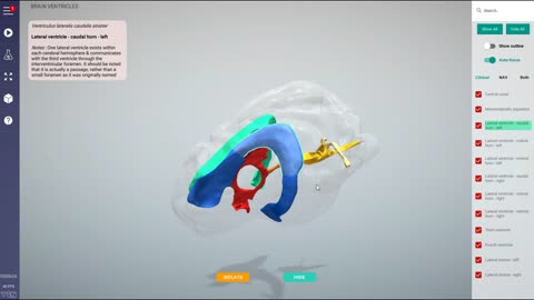 Canine brain ventricles - 3D Veterinary Anatomy & Learning IVALA