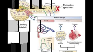 Gastrointestinal Pathology Part 4