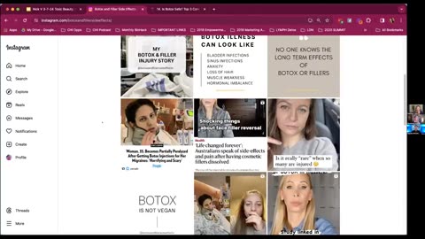 Botox & Fillers Safety