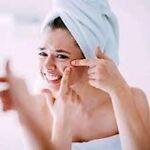 Removing Pimples and Blackheads SATISFACTORY